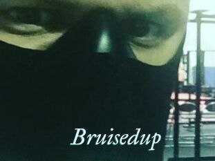 Bruisedup